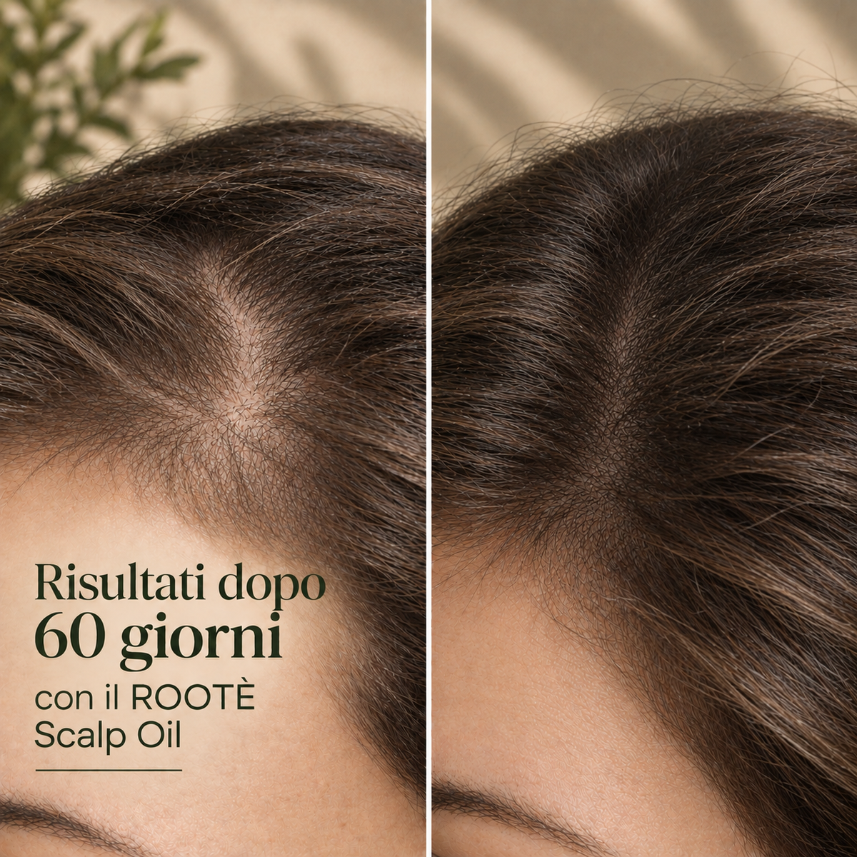 ROOTÈ Scalp Ritual
